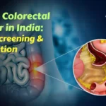 Aumento alarmante de los casos de cáncer de mama en India