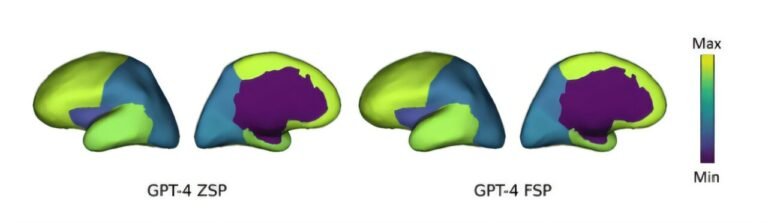ChatGPT Aids in Identifying Specific Brain Seizure Locations for Neurosurgeons” 

Rephrased: “AI Technology Assists Neurosurgeons in Precisely Locating Brain Seizure Areas