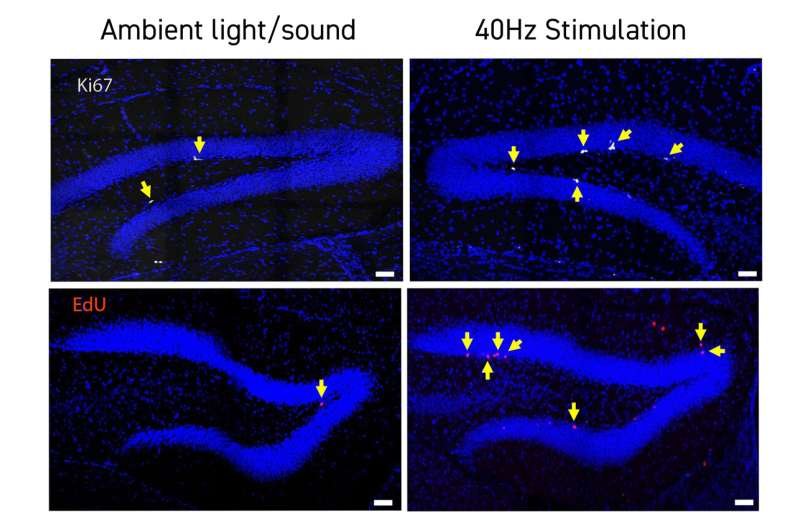 En ratones del síndrome de Down, 40Hz mejora la cognición de luz y sonido, neurogénesis, conectividad