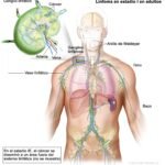 Estructuras que limitan el acceso al tratamiento del cáncer en personas con VIH.