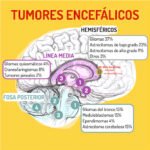 Los tumores cerebrales en niños se originan en células nerviosas especializadas desde etapas tempranas