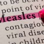 Measles Resurgence: A Wake-Up Call for Global Public Health 2 measles resurgence a wake up call for global public health