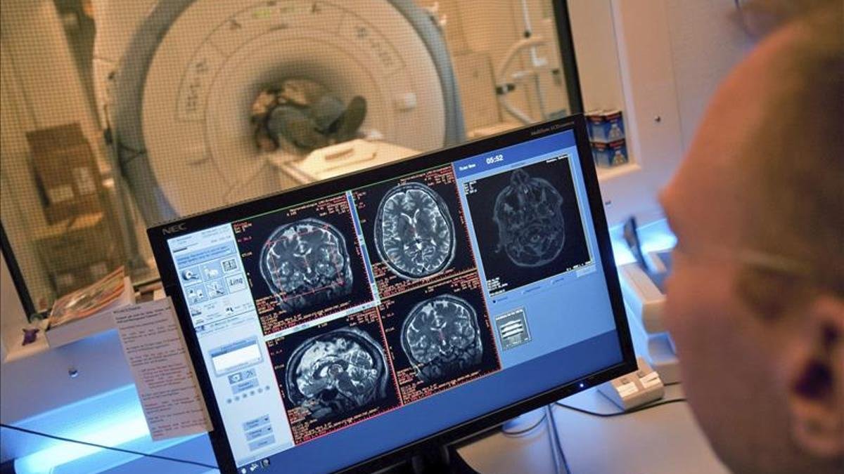 No se encuentra evidencia que respalde la “enfermedad cerebral misteriosa” en New Brunswick, según el estudio.