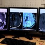 pediatria de herramienta de inteligencia artificial ayuda a prevenir el cancer cerebral 1