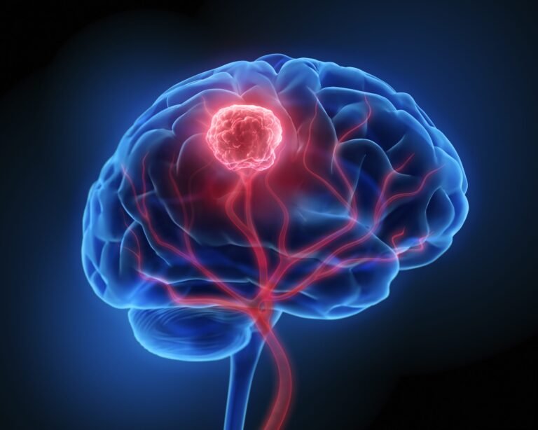 Unlocking Valuable Insights: How Laboratory Techniques Reveal Critical Information About Dangerous Brain Tumors