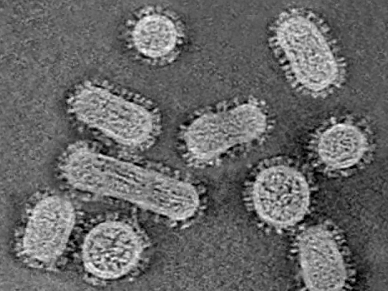 Virus bajo el Supermicroscopio: métodos para comunicarse con las células del virus de la influenza